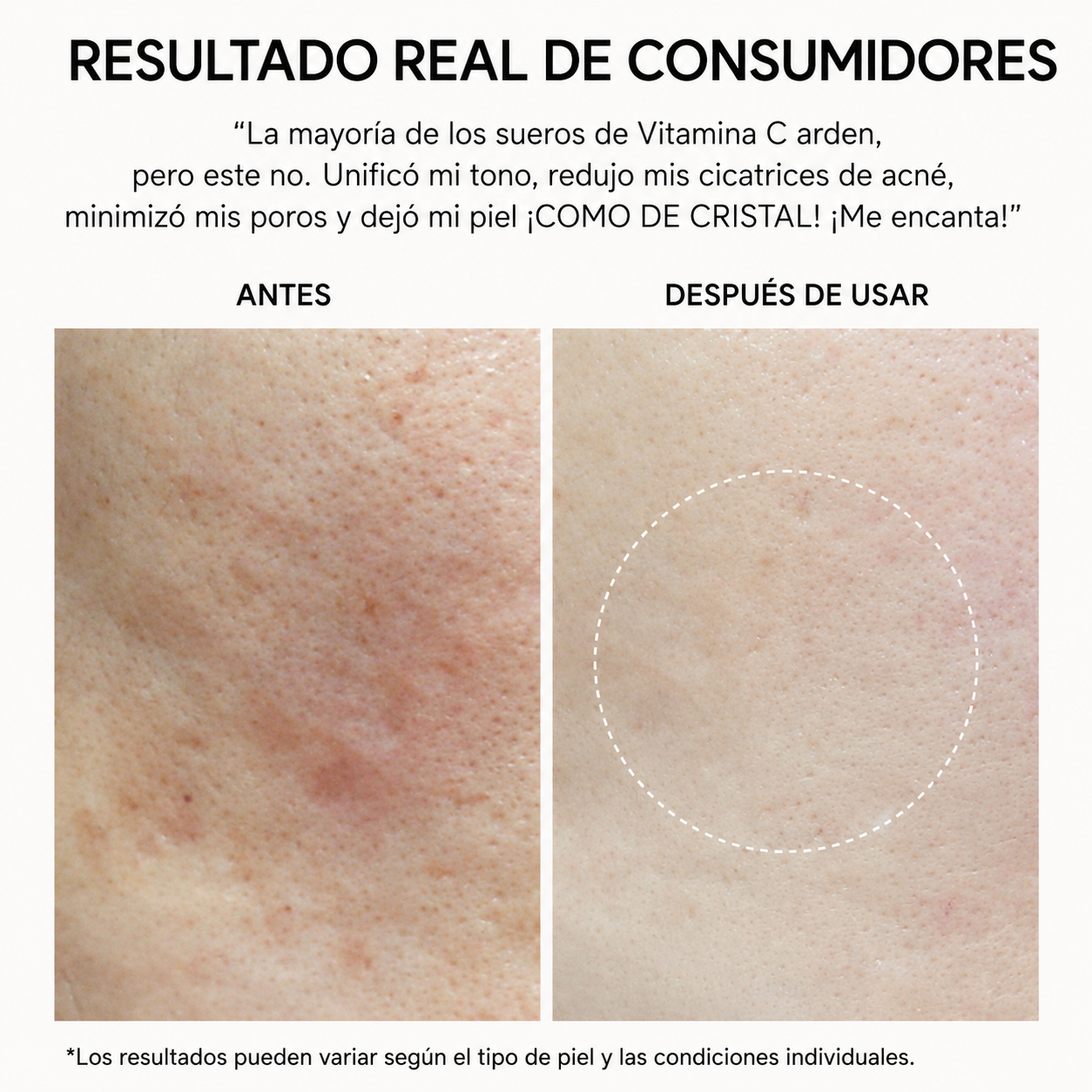 Elvora® | Shot Potenciador de Vitamina C