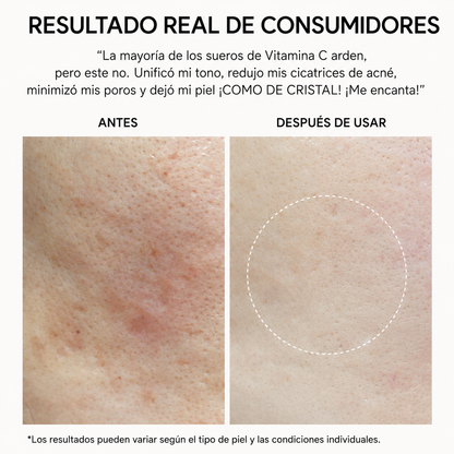 Elvora® | Shot Potenciador de Vitamina C